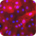 Hepatocytes Hepatocytes